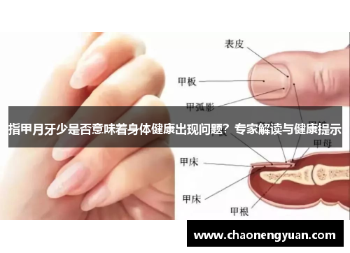 指甲月牙少是否意味着身体健康出现问题？专家解读与健康提示